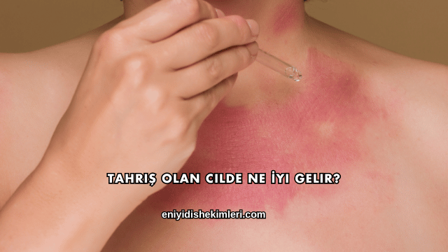 Tahriş Olan Cilde Ne İyi Gelir?