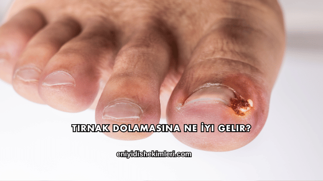 Tırnak Dolamasına Ne İyi Gelir?