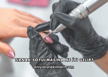Tırnak Soyulmasına Ne İyi Gelir?