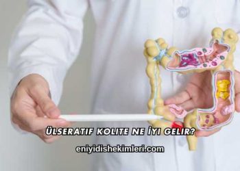 Ülseratif Kolite Ne İyi Gelir?