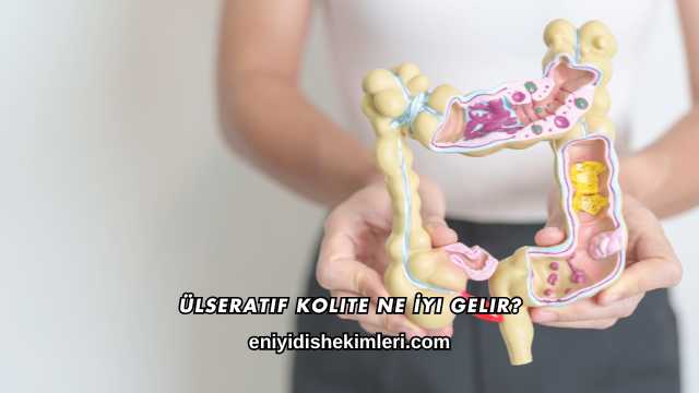 Ülseratif Kolite Ne İyi Gelir?