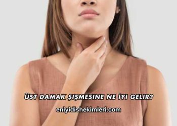 Üst Damak Şişmesine Ne İyi Gelir?