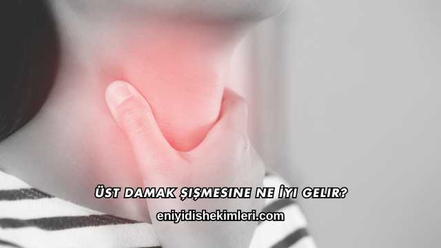Üst Damak Şişmesine Ne İyi Gelir?