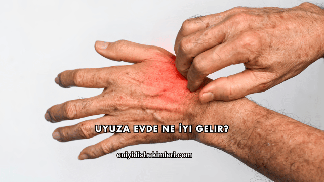 Uyuza Evde Ne İyi Gelir?