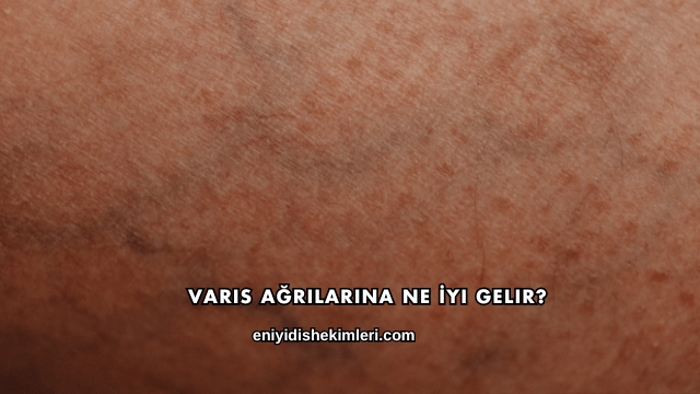 Varis Ağrılarına Ne İyi Gelir?