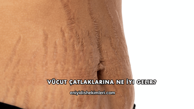 Vücut Çatlaklarına Ne İyi Gelir?