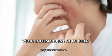 Vücut Enfeksiyonuna Ne İyi Gelir?