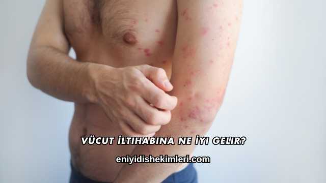 Vücut İltihabına Ne İyi Gelir?