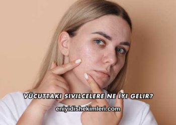 Vücuttaki Sivilcelere Ne İyi Gelir?