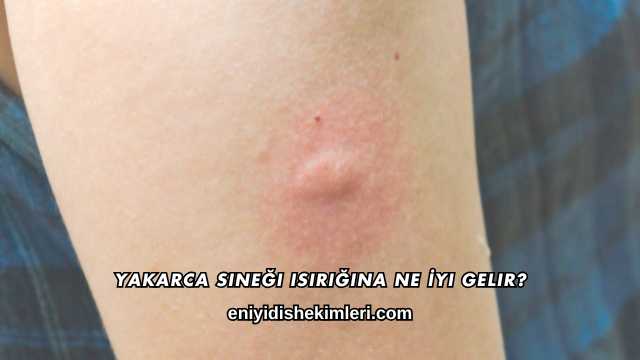 Yakarca Sineği Isırığına Ne İyi Gelir?