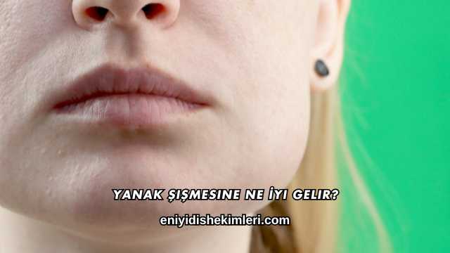 Yanak Şişmesine Ne İyi Gelir?