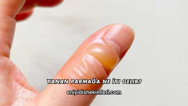 Yanan Parmağa Ne İyi Gelir?