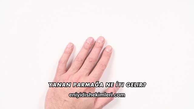 Yanan Parmağa Ne İyi Gelir?