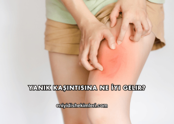 Yanık Kaşıntısına Ne İyi Gelir?