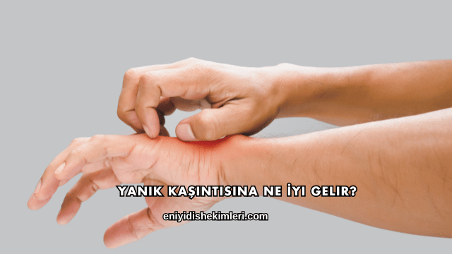 Yanık Kaşıntısına Ne İyi Gelir?