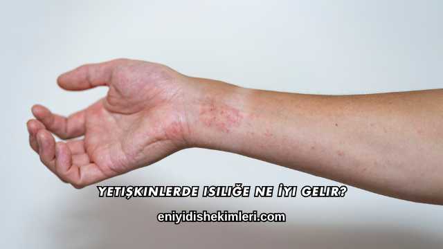 Yetişkinlerde Isiliğe Ne İyi Gelir?