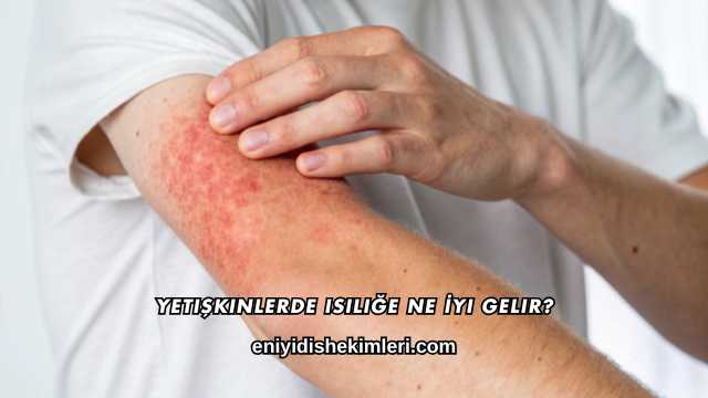 Yetişkinlerde Isiliğe Ne İyi Gelir?