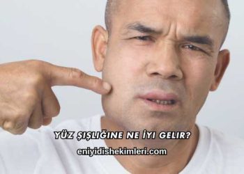 Yüz Şişliğine Ne İyi Gelir?