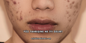 Yüz Tahrişine Ne İyi Gelir?