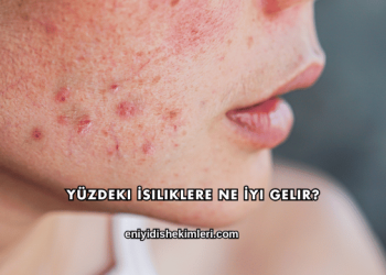 Yüzdeki İsiliklere Ne İyi Gelir?