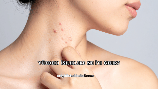 Yüzdeki İsiliklere Ne İyi Gelir?