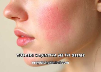 Yüzdeki Kaşıntıya Ne İyi Gelir?