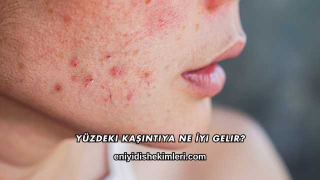 Yüzdeki Kaşıntıya Ne İyi Gelir?