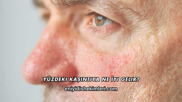 Yüzdeki Kaşıntıya Ne İyi Gelir?