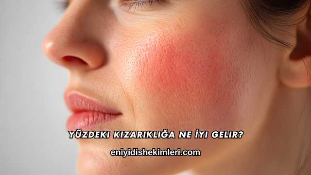 Yüzdeki Kızarıklığa Ne İyi Gelir?