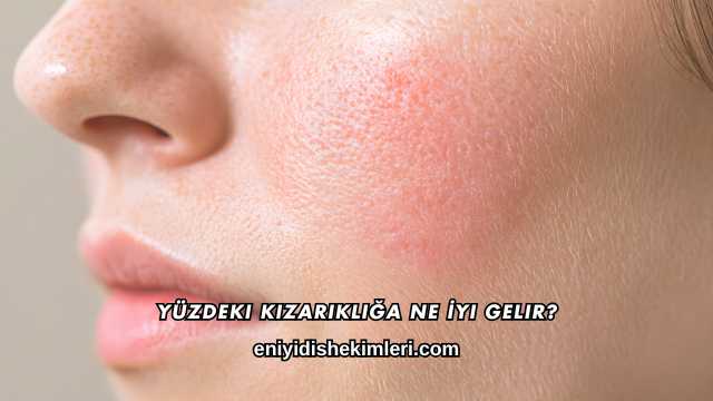 Yüzdeki Kızarıklığa Ne İyi Gelir?