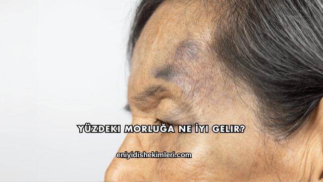 Yüzdeki Morluğa Ne İyi Gelir?