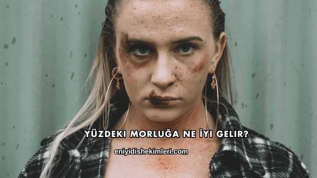 Yüzdeki Morluğa Ne İyi Gelir?