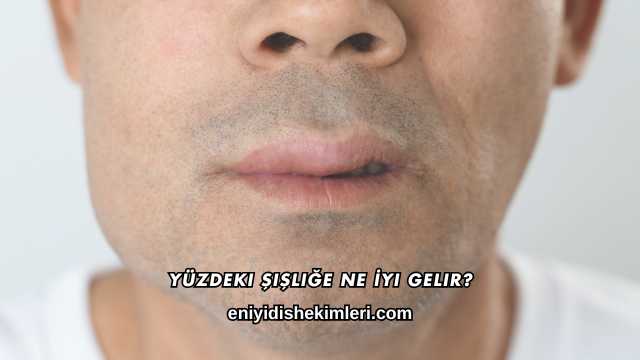 Yüzdeki Şişliğe Ne İyi Gelir?