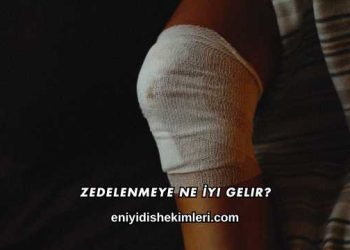 Zedelenmeye Ne İyi Gelir?