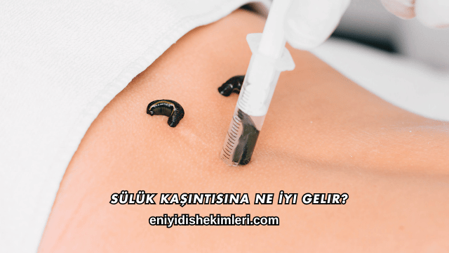 Sülük Kaşıntısına Ne İyi Gelir?