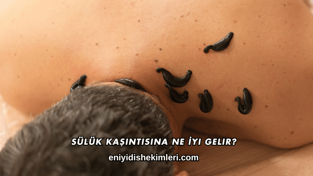 Sülük Kaşıntısına Ne İyi Gelir?