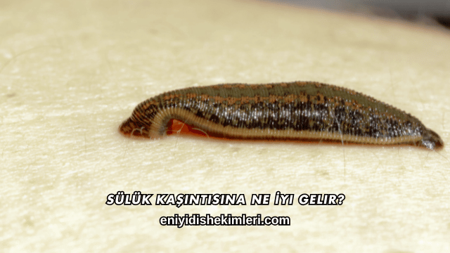 Sülük Kaşıntısına Ne İyi Gelir?