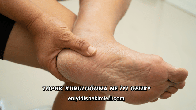 Topuk Kuruluğuna Ne İyi Gelir?