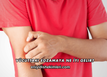 Vücuttaki Egzamaya Ne İyi Gelir?