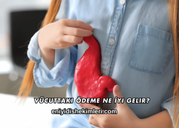 Vücuttaki Ödeme Ne İyi Gelir?