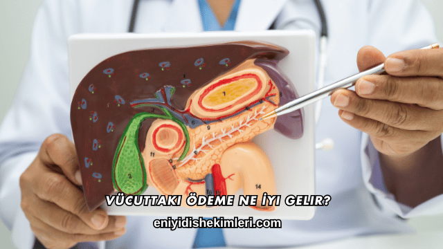 Vücuttaki Ödeme Ne İyi Gelir?