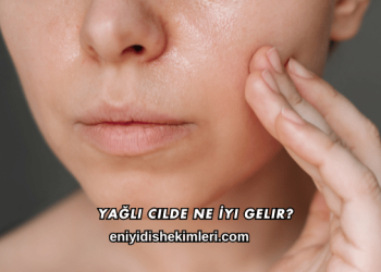 Yağlı Cilde Ne İyi Gelir?