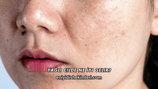 Yağlı Cilde Ne İyi Gelir?