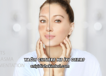 Yağlı Ciltlere Ne İyi Gelir?