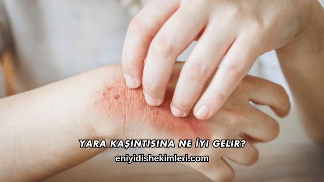 Yara Kaşıntısına Ne İyi Gelir?