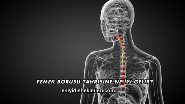 Yemek Borusu Tahrişine Ne İyi Gelir
