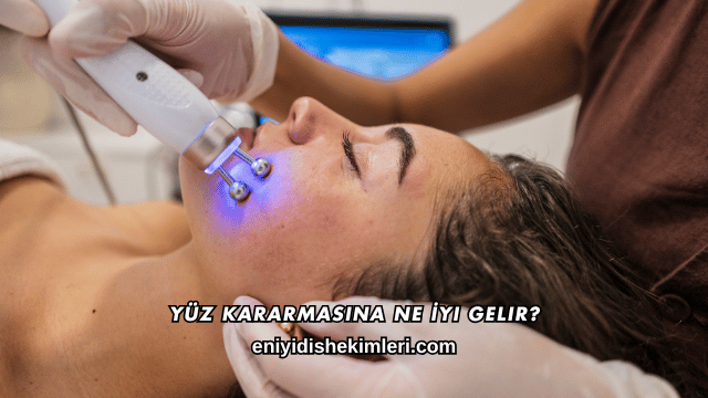 Yüz Kararmasına Ne İyi Gelir?