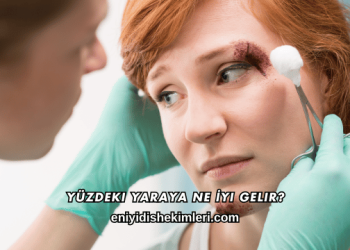 Yüzdeki Yaraya Ne İyi Gelir