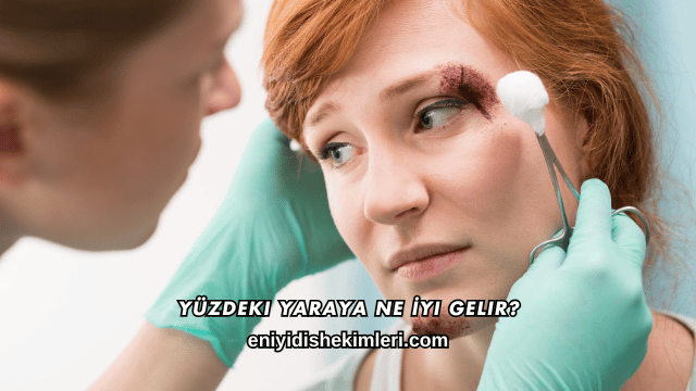 Yüzdeki Yaraya Ne İyi Gelir